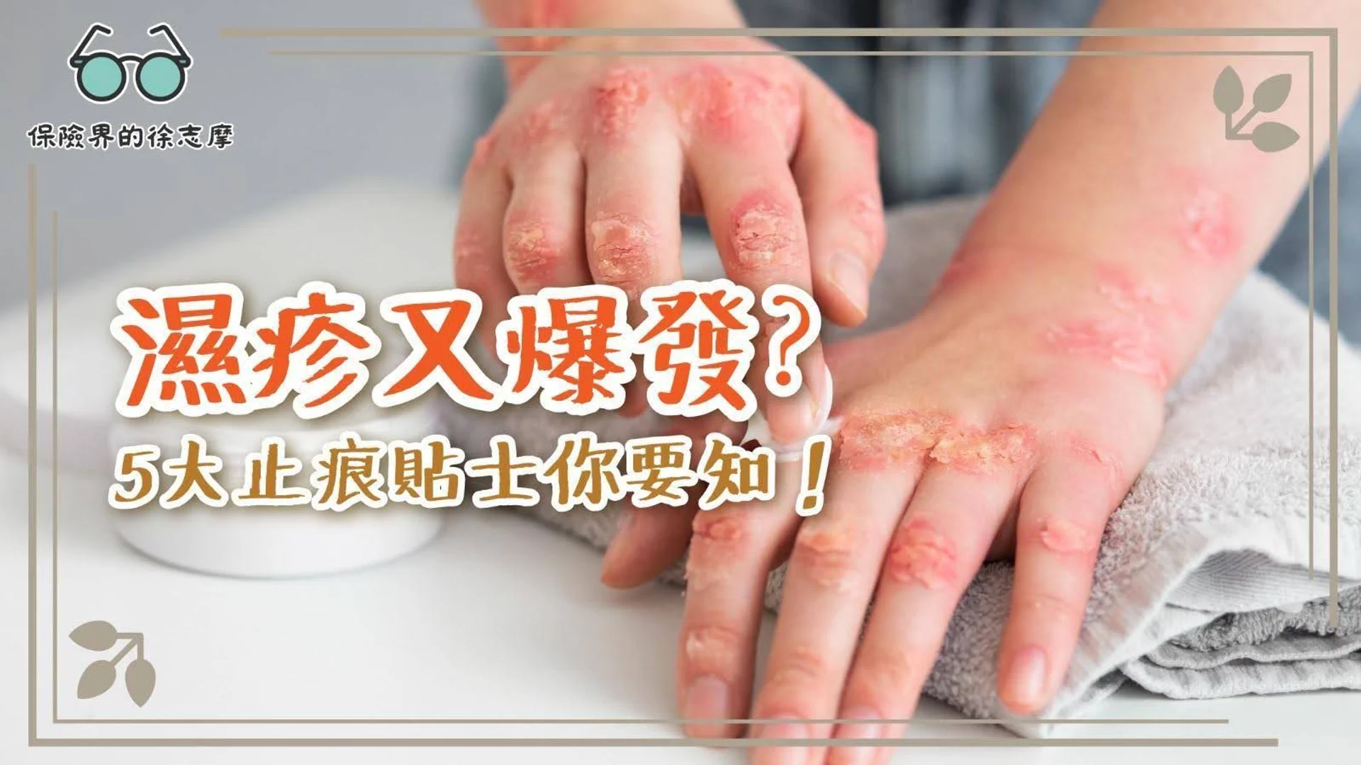 提供5個有效止痕貼士,幫助你緩解濕疹困擾,重拾舒適生活。
